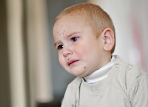 Neurodermitis: große Belastung für die Kleinen